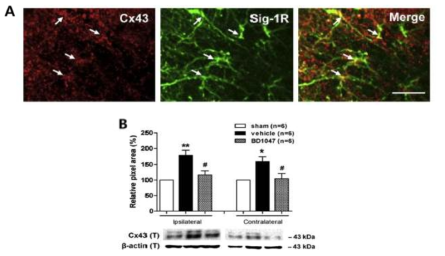 A. 척수 손상 후, sigma-1 수용체와 Cx43은 동일 세포상에 발 현함 B. sigma-1 수용체 길항제 (BD1047) 반복 처치 시 척수 손상에 의 해 Cx43의 발현 증가가 억제됨