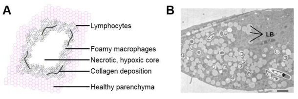 A. General scheme of a mature granuloma, with a necrotic core in its center, circled by a ribbon of immune cells, including lymphocytes in the outer part and foamy macrophages in the inner side. B. Electron microscopy view of a foamy macrophage infected with M. avium. Note the accumulation of lipidic inclusions in the bacterial cytoplasm (*). LB, lipid bodies. Scale-bar: 1 μm. From Caire-Brandli et al. 2014 Infection Immunity.