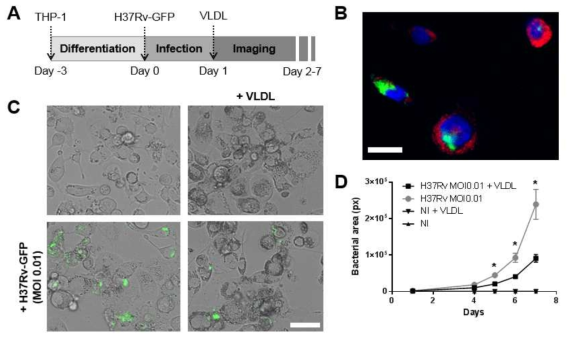 A. Experiment timeline for the generation of foamy macrophages using THP-1 cells. B. Foam cells infected with H37Rv-GFP (MOI 0.05, green) were fixed at day 4 with formalin. Nuclei were stained with DAPI (blue) and lipid bodies with LipidTox (red). Scale-bar, 25 μm. C. Representative Brightfield pictures obtained day 6 post-infection. Bacteria were detected by fluorescence (green). Scale-bar, 50 μm. D. Quantification of the bacterial replication measured by fluorescence over a 7 days experiment.