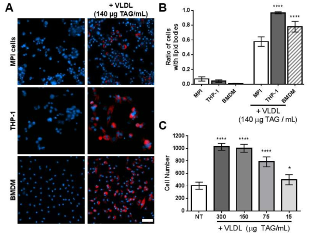 A. Representative pictures of naive and VLDL (140 μg TAG/mL) treated THP-1 cells, MPI cells or BMDM (blue). Cells were stained with LipidTOX neutral lipid dye (red). Scale bar: 50 μm. B. Comparison of the ratio of LipidTOX stained cells in the presence and absence of VLDL, for different cell types (n=9). C. Proliferation of MPI cells in presence of various amount of VLDL after 4 days incubation. Significance compared to the non-treated (NT) sample is indicated for each concentration (n=9). Statistical significance was determined by Prism software using one-way ANOVA.