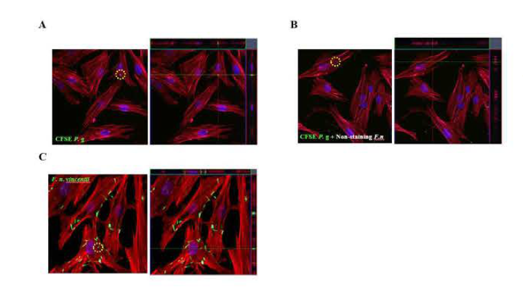 P. gingivalis 단독 (A), P. gingivalis (CFSE) + non-labeled F. nucleatum mixed infection (B), F. nucleatum 단독 (C) 감염시킨 치은섬 유아세포의 형광현미경을 통한 관찰