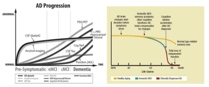 Clinical disease stages and symptoms in the progress of AD