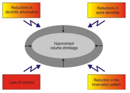 다양한 morphological change에 의한 hippocampal volume 감소