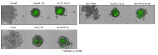 간암세포와 기질세포(Stromal cells)의 혼합배양에 따른 구상체의 치밀성 (Compactness) 변화 분석.