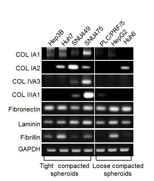 치밀성이 높은 종양 구상체와 치밀성이 낮은 종양 구상체에서의 세포외 기질 관련 유전자 발현 조사.