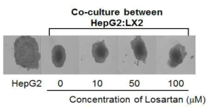 Losartan 처리에 따른 HepG2와 성상세포를 혼합 배양한 다세포성 종양 구상체의 치밀성변화 관찰.