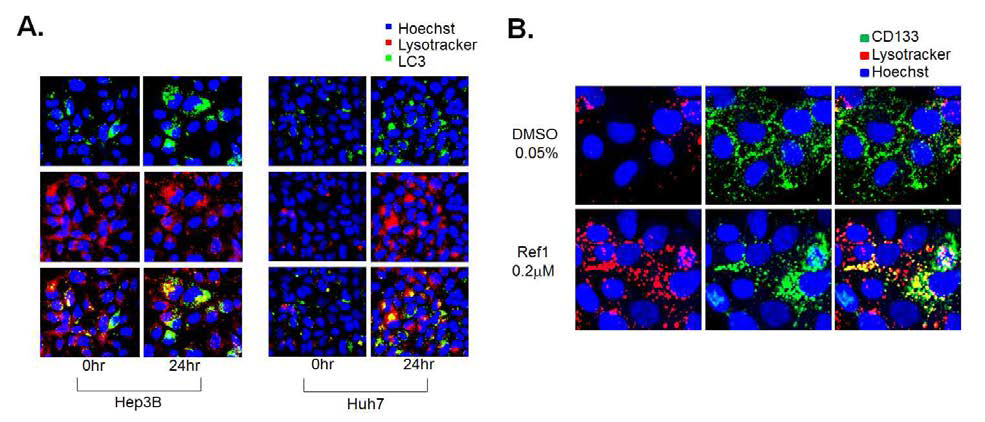 Ref 1 처리에 의한 간암세포주(A) 및 CD133 발현 간암 세포주(B)에서의 lysosome과 LC3의 변화