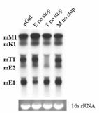 번역멈춤이 없을 때 gal operon 의 northern blot 결과