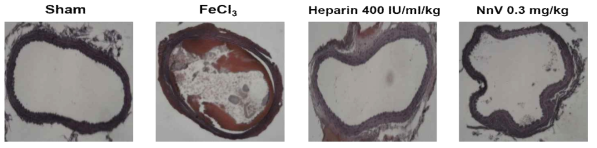 FeCl3을 이용한 동맥 혈 모델에서의 처리군에 따른 병리학적 변화(H&E 염색법, 100배 관찰)