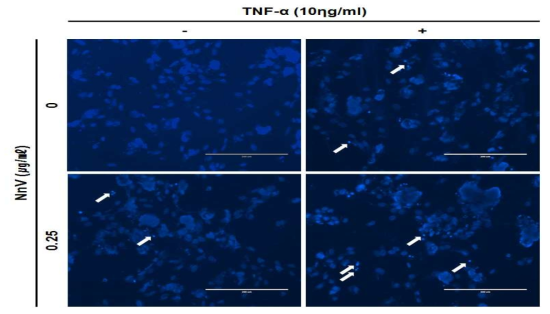 동맥평활근 세포에서 NnV의 세포사멸사 유도 효과