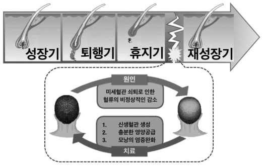 모발의 성장주기 및 진단 필요성