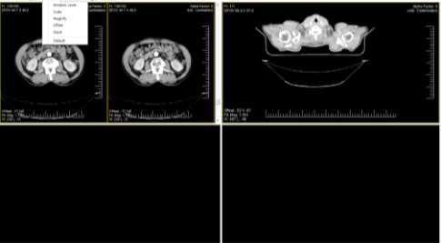 Dicom viewer action