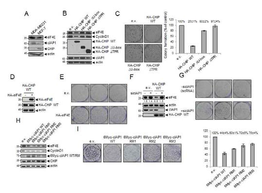 The balanced expression of cIAP1 and CHIP in breast cancer cell lines might be crucial in eIF4E-driven tumorization