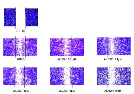 AIU에 의한 세포이동능 억제 효과
