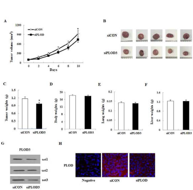 마우스에 방사선내성 세포주 이식후 PLOD3억제시의 종양의 크기 변화