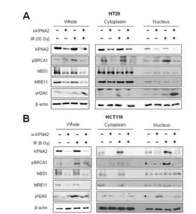 siRNA KPNA2에 의한 핵 내 DNA 회복 인자의 발현 확인