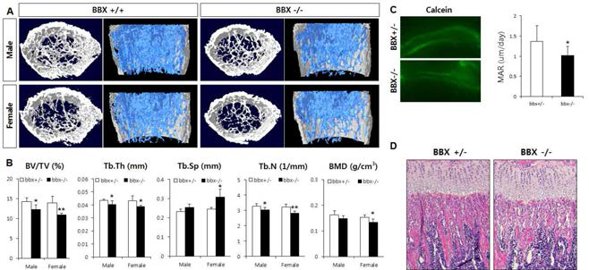 4주령 BBX 결손마우스를 이용한 골조직 분석