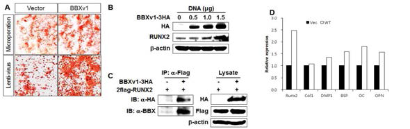 BBXv1 과발현에 의한 조골세포 분화 및 Runx2와 상호작용