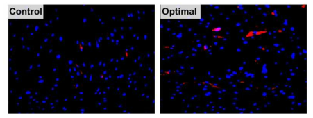 최적 표면/기하자극 플랫폼 상 중간엽줄기세포의 내피세포 분화 확인을 위한 DAPI(청), Ac-LDL(적) 염색
