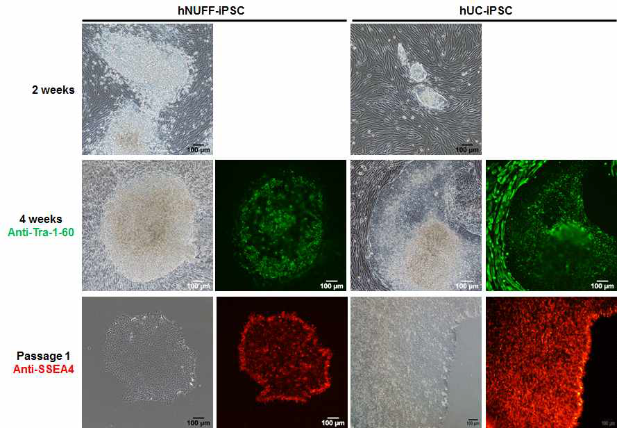 hNUFF-iPSC와 hUC-iPSC의 줄기세포 마커 염색