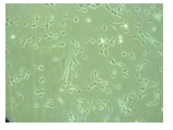 유도만능줄기세포 유래 중간엽줄기세포의 모양 확인