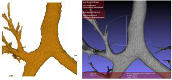 CT영상을 통해 획득한 볼륨 데이터 형태의 폐구조물(좌)과 이를 폴리곤 구조로 변환한 결과(우)