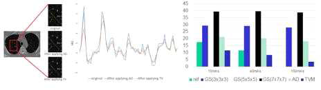 CT 영상에서의 잡음 감쇄 기술 적용 전과 후의 결과 비교 그래프; 원본 영상과 비교 시, 15 mAs의 저선량 CT에서 TVM 기술을 적용했을 시, AD보다 1.8배 낮은 root mean square error 결과를 확인함