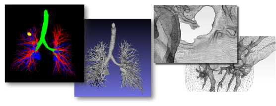 자체 개발한 고성능 분할 알고리즘을 통해 3D 흉부 CT에서 기관지, 폐동맥, 폐정맥, 종양을 각각 추출하고 볼륨 렌더링과 폴리곤 렌더링으로 가시화한 예(좌)와 3D 복부 MRI영상에서 간문맥을 추출하고 표면 변환 완료한 STL 추출물 가시화 사례(우)