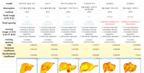 실제 인체장기 모델과 영상 데이터의 정확성 평가