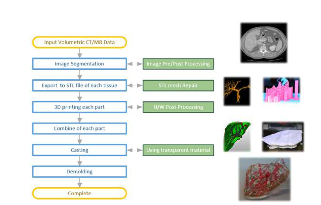 환자맞춤형 장기모형 제작을 위한 3D 프린팅 제작 흐름도