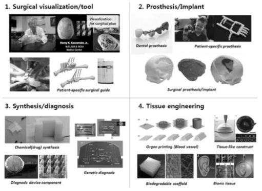 의료바이오 분야 3D 프린팅 기술활용 사례