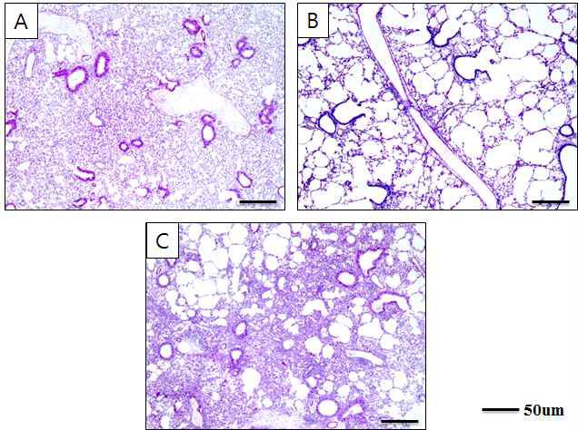 당귀수산의 emphysema 억제효과