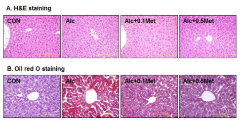 Effect of Metformine on (A) histopathology and (B) lipid accumulation in the liver of alcohol-challenged mice.