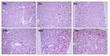 Changes in lipid accumulation in the kidney of tunicamycin-treated mice.