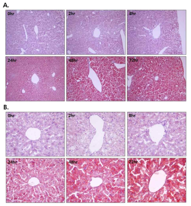 Changes in lipid accumulation in the liver of tunicamycin-treated mice.