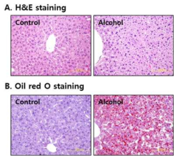 Histological assessment of the liver in acute alcohol-treated mice.