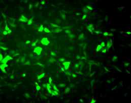 형광 유전자를 유도시켜 만든 암 전이 실험용 세포주 MDA-MB-436 전이성 유방암 세포주에 GFP 발광을 하게 만듬