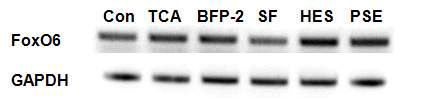 수지상세포의 FoxO6 유전자 발현조절 인자 탐색