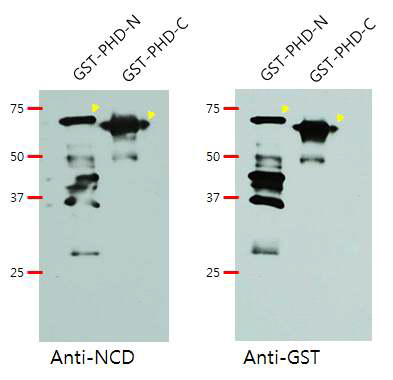 GST:PHD-N, GST:PHD-C의 western blot 결과