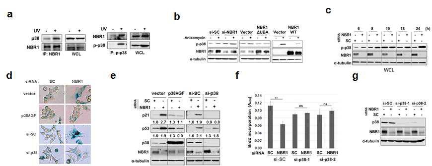 NBR1 silencing에 의한 세포노화에서 p38의 활성화와 중요성
