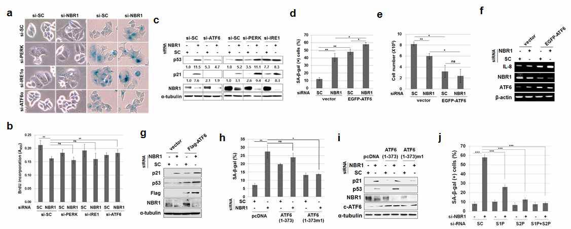 NBR1 silencing에 의한 세포노화 유도에서 UPR-ATF6α의 중요성
