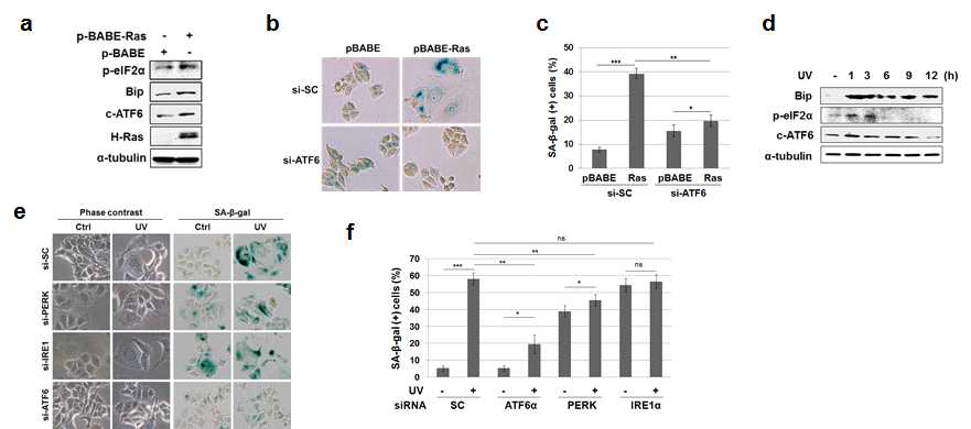 Ras과발현과 자외선 조사에 의한 세포노화에서 UPR-ATF6α의 중요성