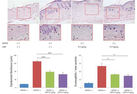 아스파탐에 의한 아토피 피부염 조직에의 호산구 침윤 억제와 표피층의 비후 억제 효과
