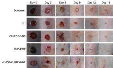 Duoderm, GCH, PDGF-BB, VEGF, 및 PDGF-BB/VEGF를 포함하는 수용성 키토산 하이드로겔을 이용한 피부 치유 효과를 보여주는 사진들