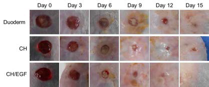 Duoderm, GCH 및 EGF를 포함하는 수용성 키토산 하이드로겔을 이용한 피부 치유 효과를 보여주는 사진들