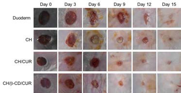 Duoderm, GCH, CUR 및 β-CD/CUR을 포함하는 수용성 키토산 하이드로겔을 이용한 피부 치유 효과를 보여주는 사진들