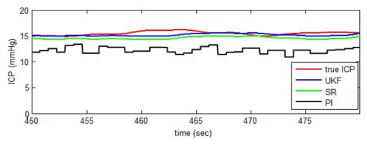 비침습적 ICP 추정 결과 (임상데이터)