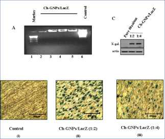 Chitosan gold nano composite를 이용한 골아세포에 유전자 전달 및 발현