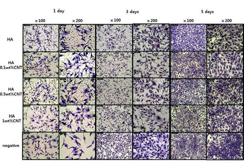 MWCNTs, HA및 MWCNTs-HA혼랍 분말의 세포독성평가에 따른 세포 형태학적 분석 결과