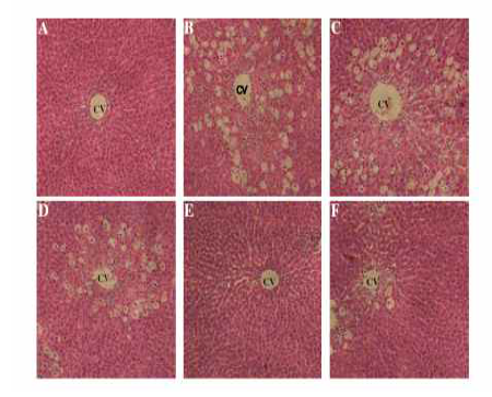 Histopathology of liver tissues.